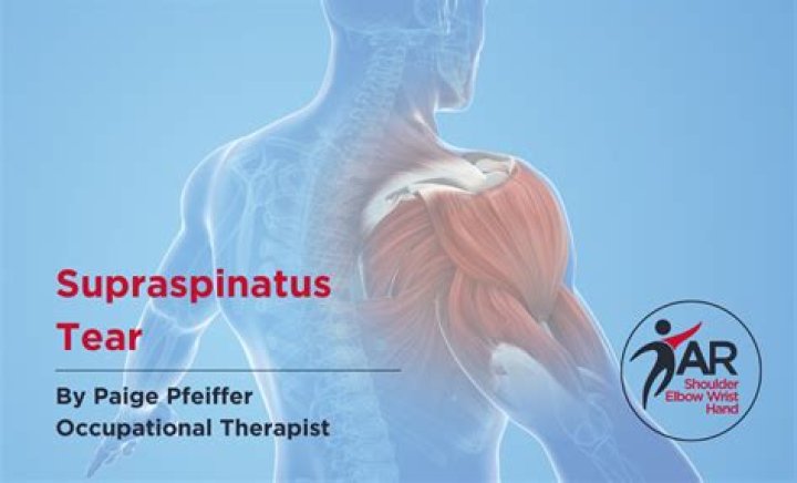 Can a torn supraspinatus heal on its own?