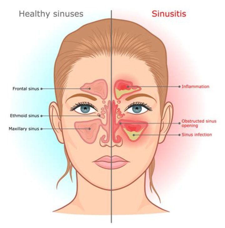 Can inflammation make you nauseous?