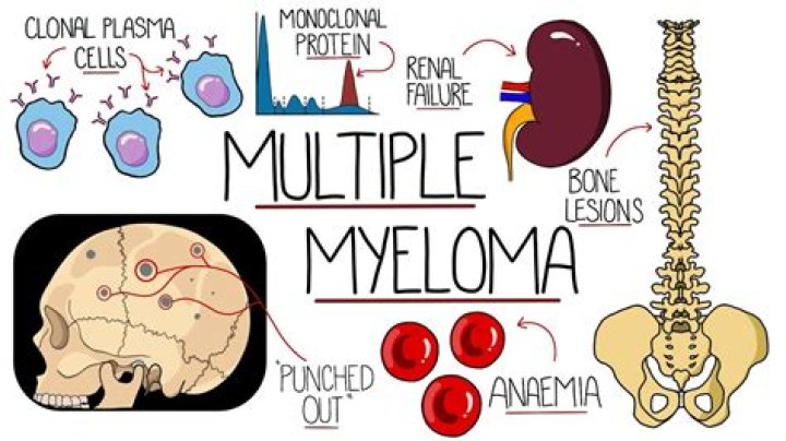 Can multiple myeloma affect the heart
