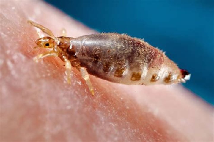 can you get lice from a pool