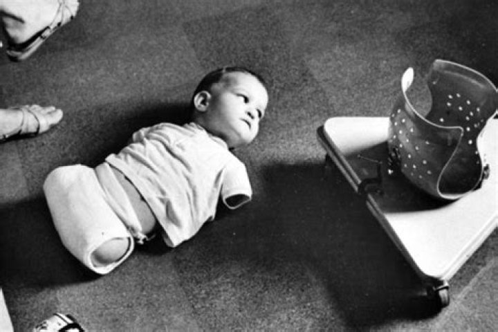 Can you still get Thalidomide?