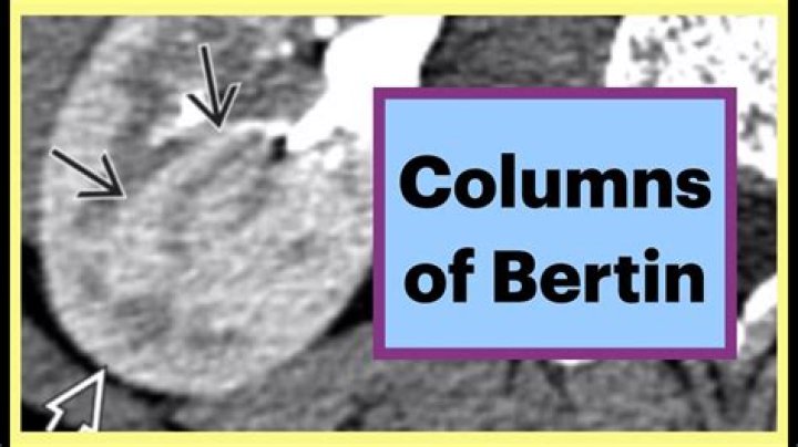 columns of bertini are found in