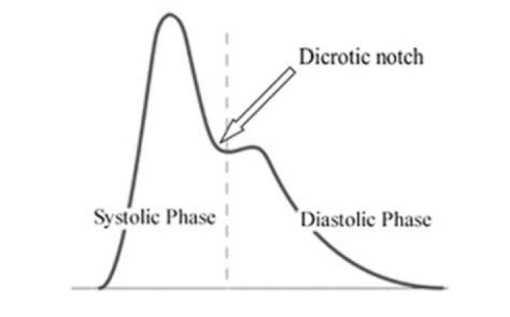 dicrotic notch