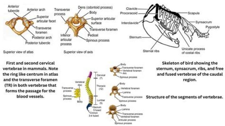 Do annelids have a backbone