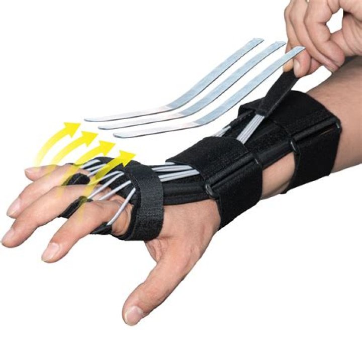 Do hand splints work for carpal tunnel?