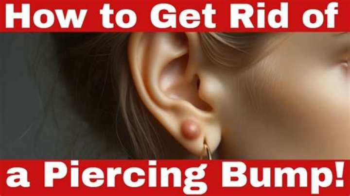do piercing bumps go away