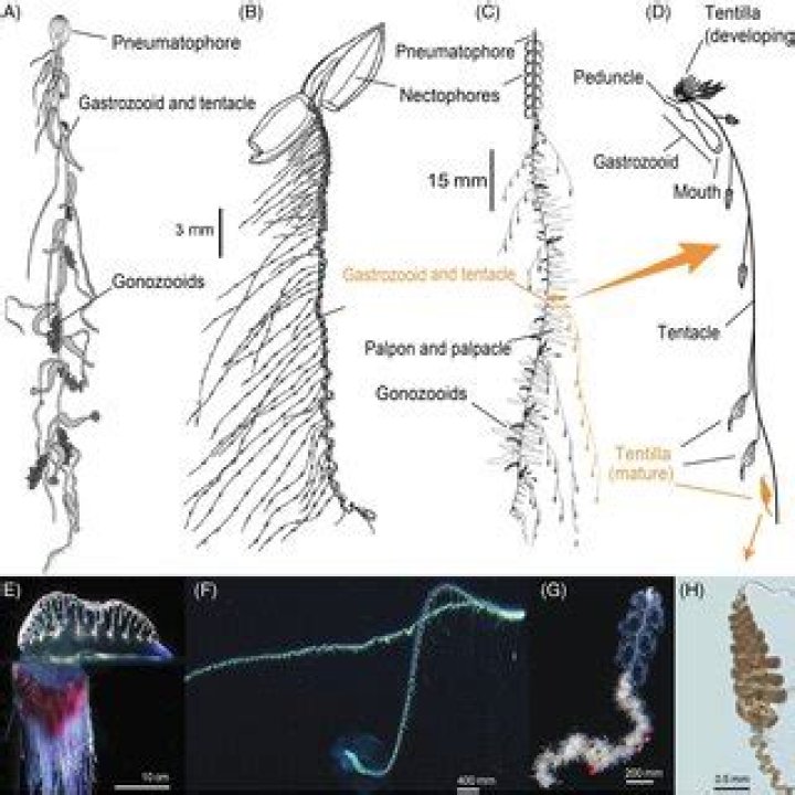 Do Siphonophores sting