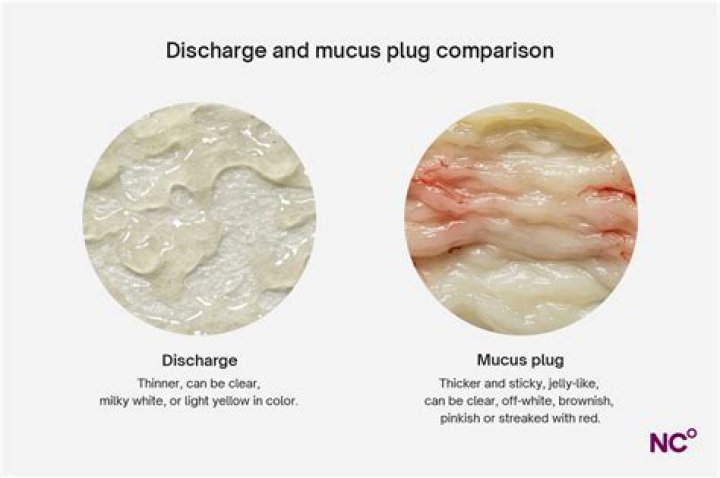 does cheese cause mucus