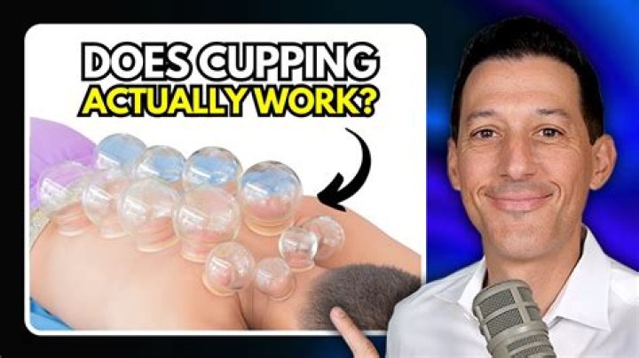 Does Chinese cupping really work?