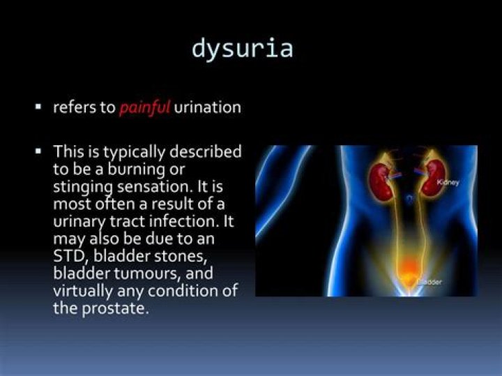 dysuria medical definition