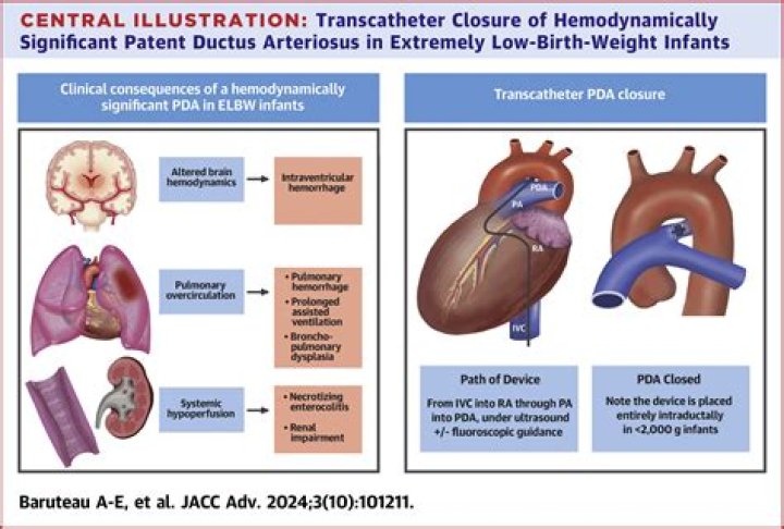 hemodynamically