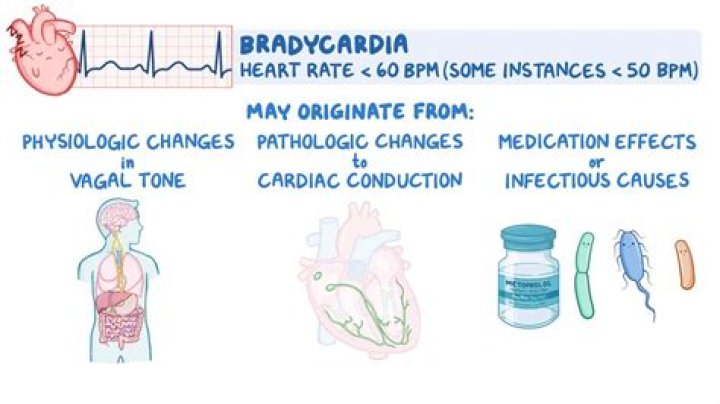 How do you cure bradycardia