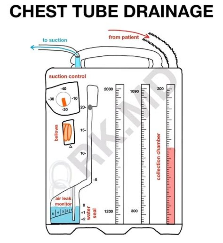 How do you drain a chest tube drain