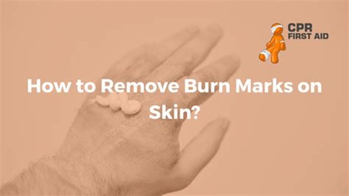 How do you remove burn marks from vinyl?