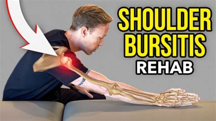 How do you treat bursitis of the shoulder
