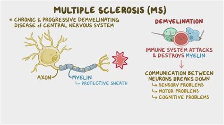 How does Copaxone work as treatment for multiple sclerosis