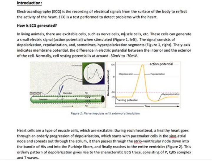 How is ECG generated