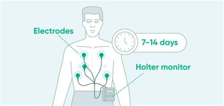 How many leads does a Holter monitor have quizlet