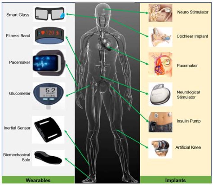 How many stents can be implanted