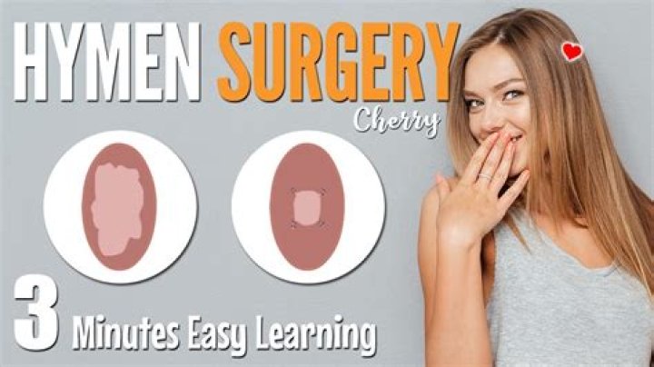 How much is a Hymenectomy