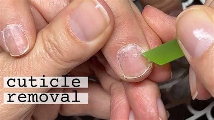 how to stop cuticle bleeding