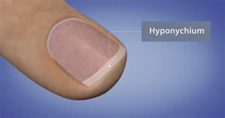 hyponychium