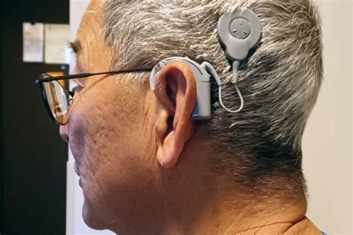 Is a cochlear implant a computer?