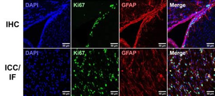 Is Aspen good for staining