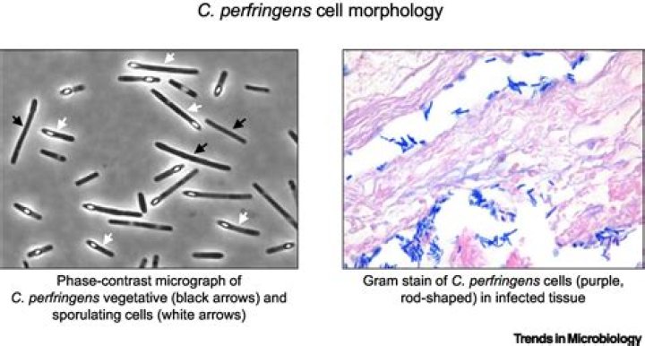 Is Clostridium Sporogenes a strict anaerobe