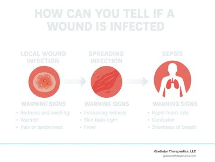 Is it bad to cover an infected wound?