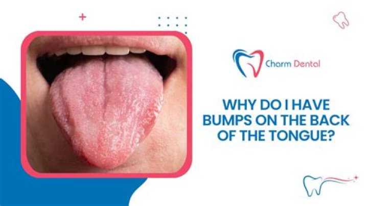 Is it normal to have bumps on the back of your tongue and throat?
