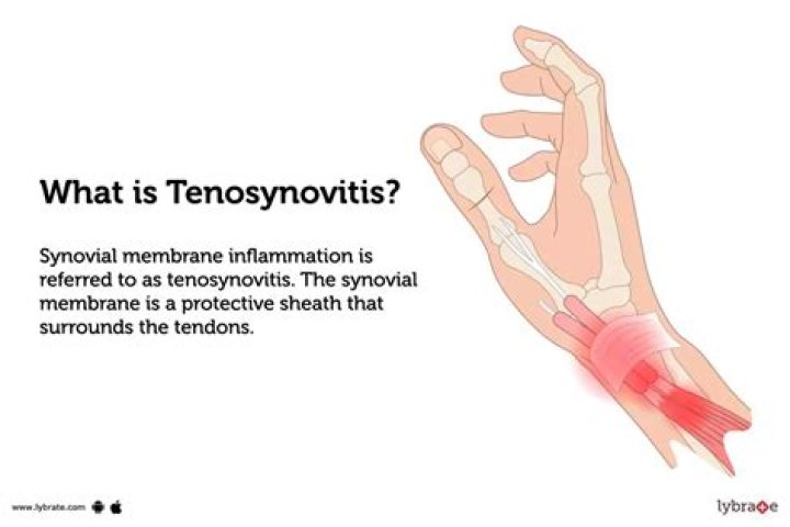 Is tendonitis the same as tenosynovitis