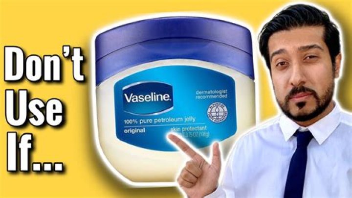 is vaseline good for acne