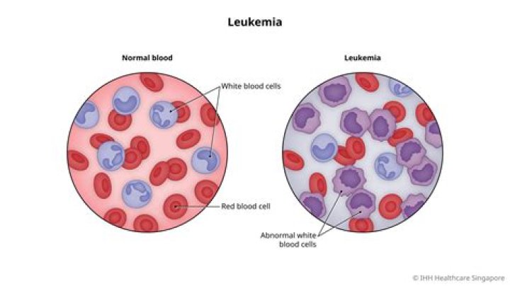 leukemia medical term