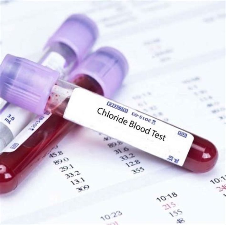 low chloride blood test
