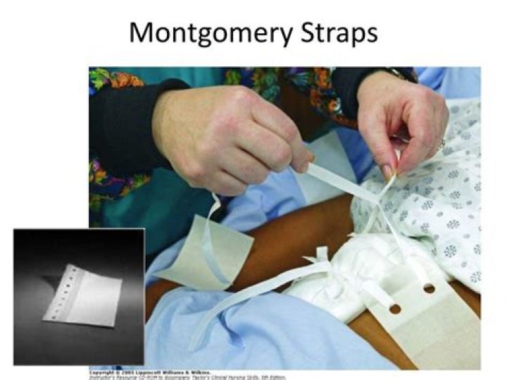 montgomery straps