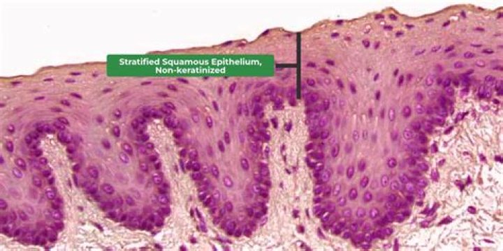 nonkeratinized stratified squamous