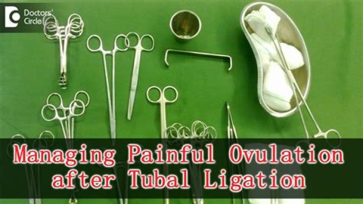 ovulation after tubal ligation