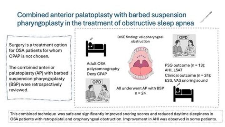 palatoplasty medical term