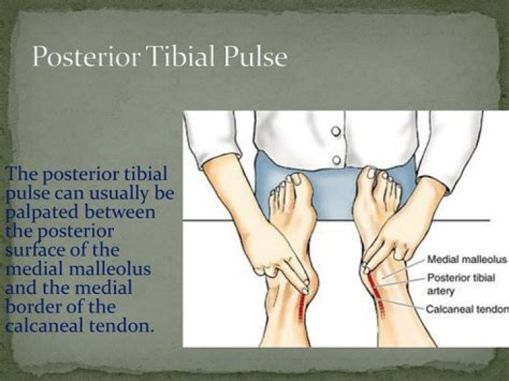 posterior tibial pulse