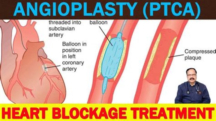 ptca full form in medical