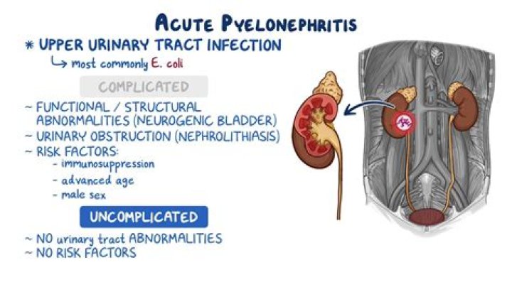 pyelonephritis icd 10