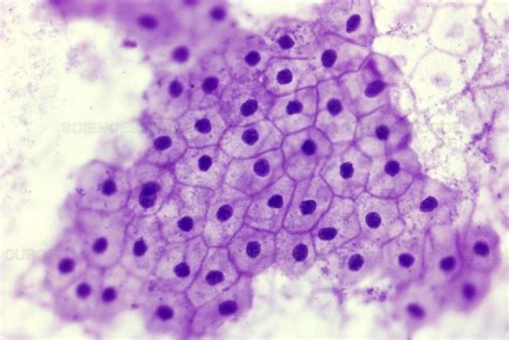 simple squamous