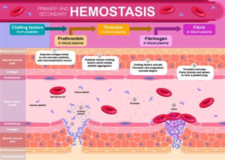 What are the five steps of hemostasis
