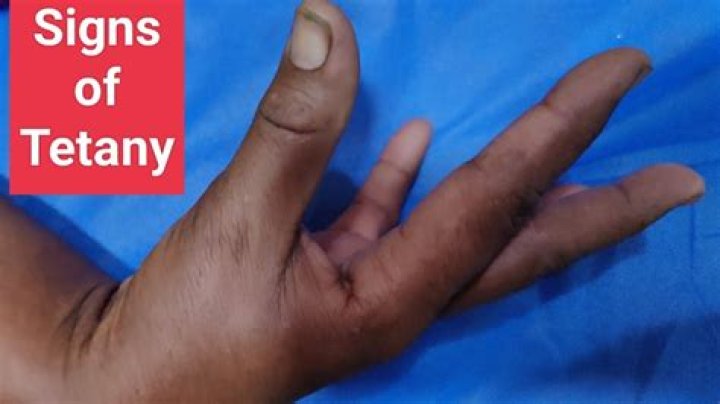 What are the signs of tetany?