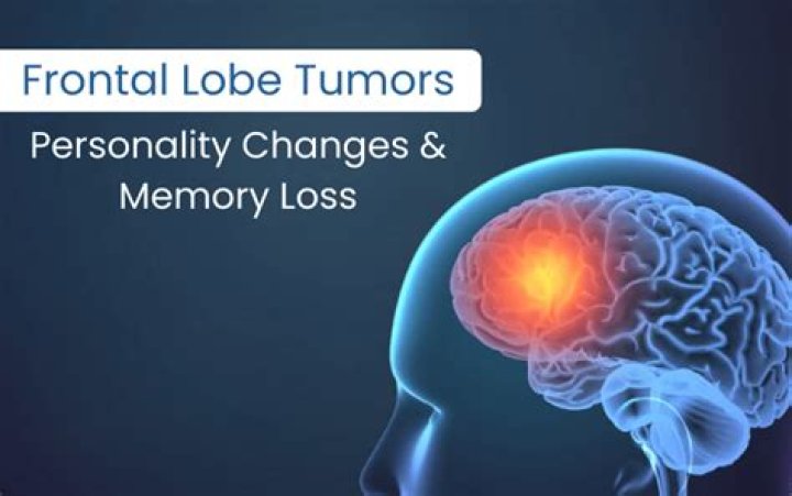 What are the symptoms of a frontal lobe tumor