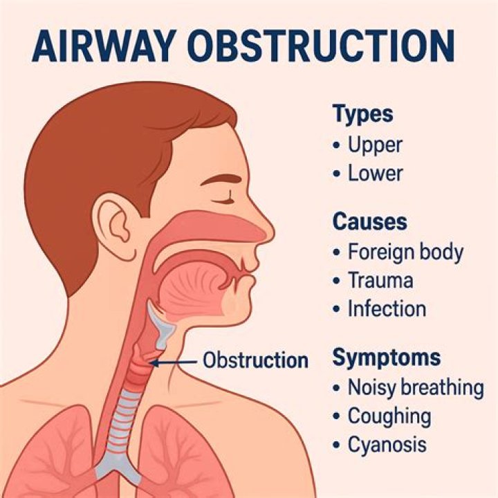 What can cause airway swelling
