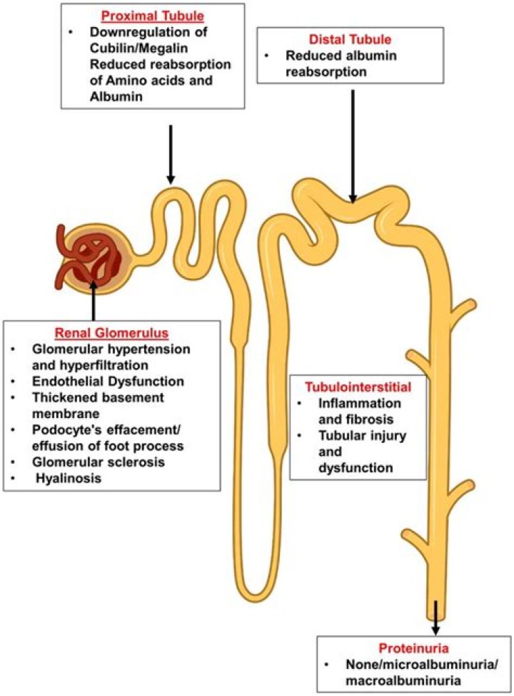 What causes albuminuria
