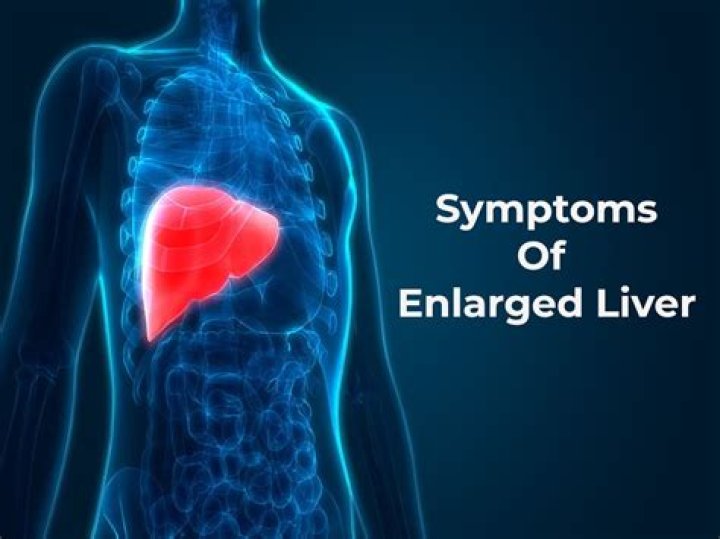 What causes enlarged liver?