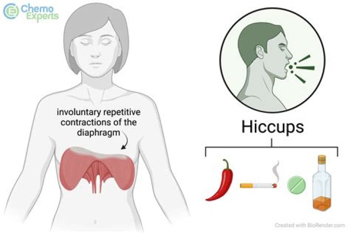 what causes hiccups in us